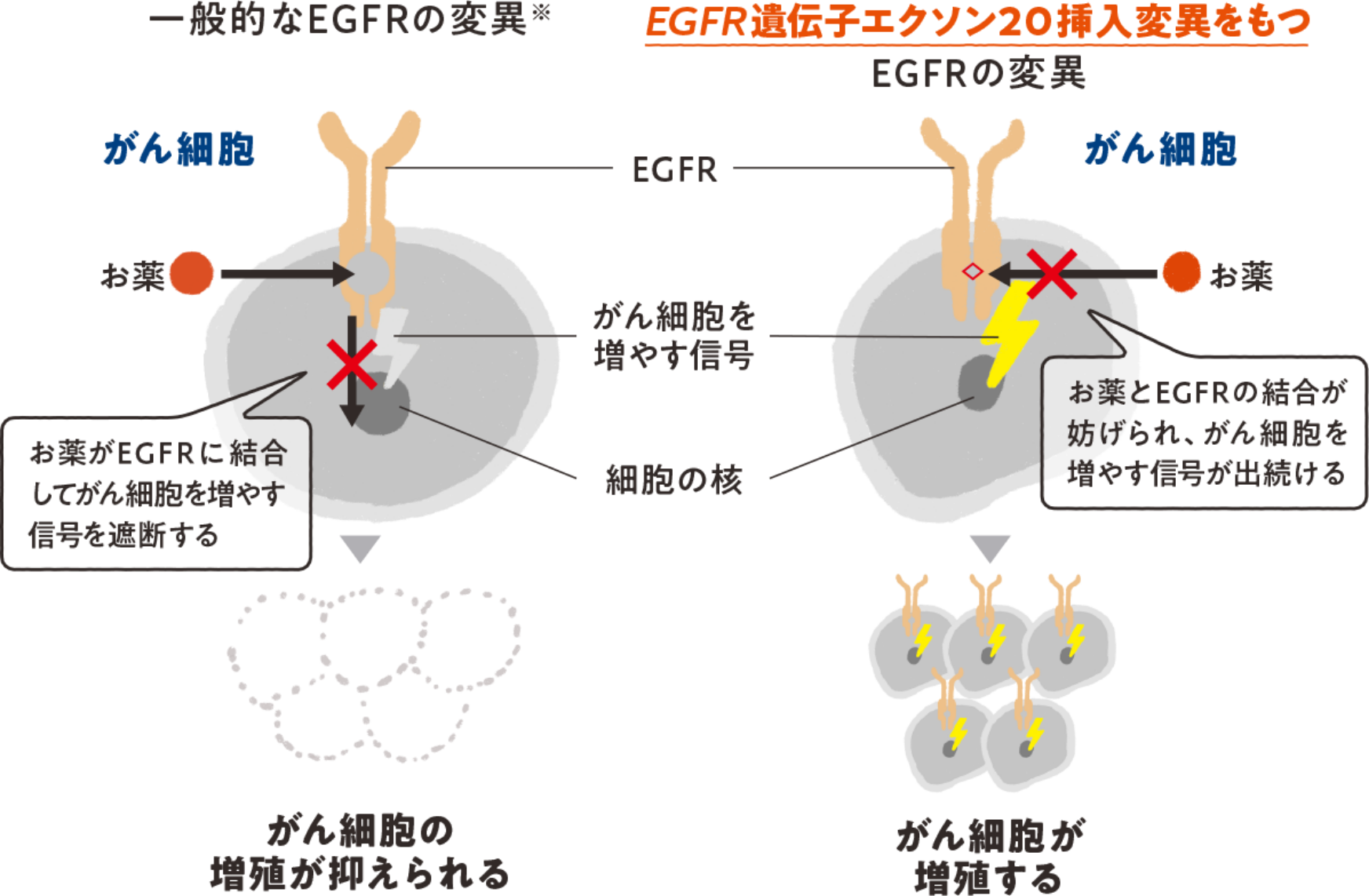 EGFR遺伝子変異の種類