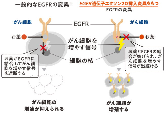 EGFR遺伝子変異の種類